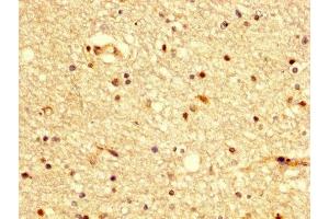 IHC image of ABIN7145183 diluted at 1:300 and staining in paraffin-embedded human brain tissue performed on a Leica BondTM system. (BDKRB2 antibody  (AA 336-391))