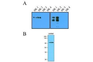 A): Recombinant protein (20ng or 100ng) of Hexokinase four isoform were resolved by SDS-PAGE, transferred to nitrocellulose membrane and probed with anti-human Hexokinase I, II (1:1000). (Hexokinase-1/2 (AA 1-917) antibody)