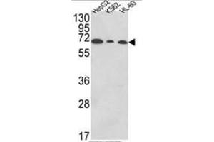 Western blot analysis of PIGR Antibody (C-term) in HepG2,K562,HL-60 cell line lysates (35ug/lane). (PIGR antibody  (C-Term))