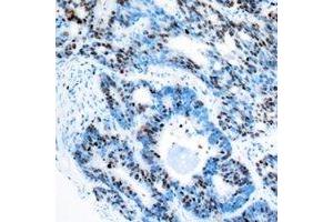 Immunohistochemistry (IHC) image for anti-Retinoblastoma Binding Protein 5 (RBBP5) antibody (ABIN7308262) (RBBP5 antibody)