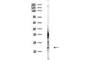 anti-DIRAS Family, GTP-Binding RAS-Like 2 (DIRAS2) (C-Term) antibody