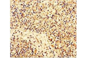 Immunohistochemistry of paraffin-embedded human spleen tissue using ABIN7159348 at dilution of 1:100 (Majin (AA 1-216) antibody)