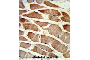 Formalin-fixed and paraffin-embedded human skeletal muscle reacted with TAGLN Antibody , which was peroxidase-conjugated to the secondary antibody, followed by DAB staining.