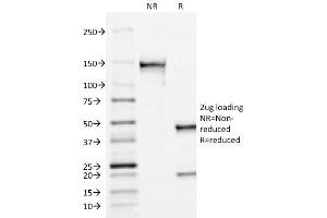 SDS-PAGE Analysis Purified PSAP Mouse Monoclonal Antibody (ACPP/1338).