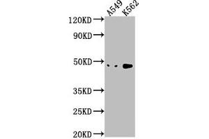Western Blot Positive WB detected in: A549 whole cell lysate, K562 whole cell lysate All lanes: NKAPL antibody at 1:1000 Secondary Goat polyclonal to rabbit IgG at 1/50000 dilution Predicted band size: 47 kDa Observed band size: 47 kDa (NKAPL antibody  (AA 114-123))