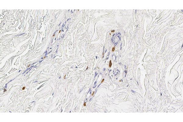 Mast Cell Tryptase antibody