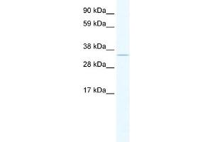 WB Suggested Anti-SIRT2 Antibody Titration:  0. (SIRT2 antibody  (C-Term))