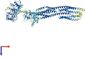 alpha Actinin 4 Protein (AA 1-912) (His tag)