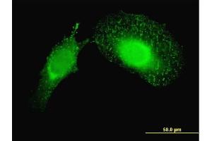 Immunofluorescence of monoclonal antibody to PDCD6IP on HeLa cell. (ALIX antibody  (AA 1-110))