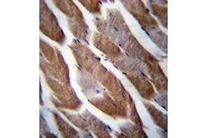 Immunohistochemistry analysis in formalin fixed and paraffin embedded human skeletal muscle reacted with Matrilin-1 Antibody (C-term) followed which was peroxidase conjugated to the secondary antibody and followed by DAB staining. (MATN1 antibody  (C-Term))