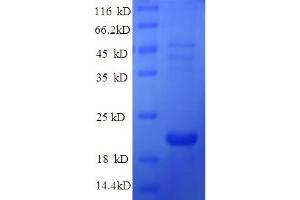 Defb14 Protein (AA 23-67) (His-SUMO Tag)