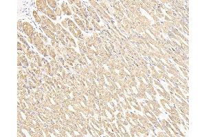 Immunohistochemistry analysis of paraffin-embedded mouse stomach cancer using CK-7 Monoclonal Antibody at dilution of 1:300. (Cytokeratin 7 antibody)