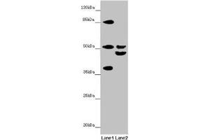 Western blot All lanes: NYX antibody at 7. (Nyctalopin antibody  (AA 282-481))