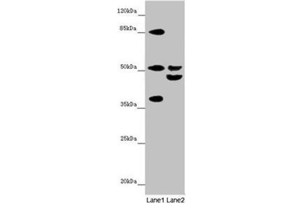 Nyctalopin anticorps  (AA 282-481)