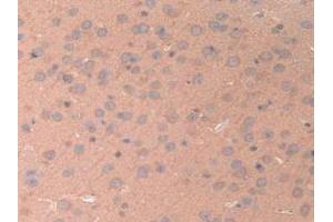 Detection of ANGPTL2 in Mouse Brain Tissue using Polyclonal Antibody to Angiopoietin Like Protein 2 (ANGPTL2) (ANGPTL2 antibody  (AA 267-493))