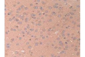 Detection of ANGPTL2 in Mouse Brain Tissue using Polyclonal Antibody to Angiopoietin Like Protein 2 (ANGPTL2)