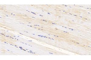 Detection of CASP6 in Bovine Skeletal muscle Tissue using Polyclonal Antibody to Caspase 6 (CASP6) (Caspase 6 antibody  (AA 81-179))