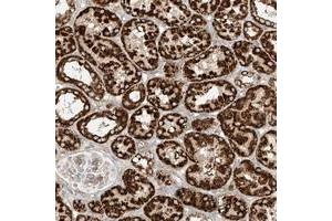 Immunohistochemical staining of human kidney with PLCL1 polyclonal antibody  shows strong cytoplasmic positivity, with a granular pattern in renal tubular cells at 1:200-1:500 dilution. (PLCL1 antibody)