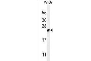 Western Blotting (WB) image for anti-Chromosome 19 Open Reading Frame 84 (C19orf84) antibody (ABIN2995151) (C19orf84 antibody)
