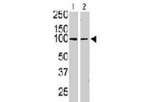 The KIT polyclonal antibody  is used in Western blot to detect KIT in serum-starved HeLa cell lysate (lane 1) and primate testis tissue lysate (lane 2) . (KIT antibody  (N-Term))