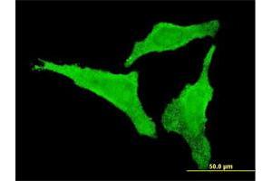 Immunofluorescence of monoclonal antibody to CDKL2 on HeLa cell. (CDKL2 antibody  (AA 394-493))