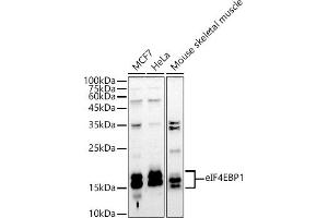 Western blot analysis of extracts of various cell lines, using eIF4EBP1 antibody (ABIN3021843, ABIN3021844, ABIN3021845 and ABIN1512858) at 1:1000 dilution. (eIF4EBP1 antibody  (C-Term))