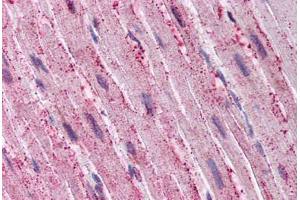Human Heart (formalin-fixed, paraffin-embedded) stained with ADAMTS4 antibody ABIN290073 at 20 ug/ml followed by biotinylated goat anti-rabbit IgG secondary antibody ABIN481713, alkaline phosphatase-streptavidin and chromogen. (ADAMTS4 antibody  (C-Term))