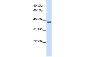 WB Suggested Anti-RASSF7 Antibody Titration: 0. (RASSF7 antibody  (Middle Region))