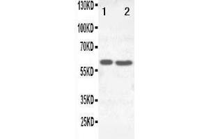 Anti-SLC22A6 antibody, Western blotting Lane 1:  Cell Lysate Lane 2: HELA Cell Lysate (SLC22A6 antibody  (C-Term))