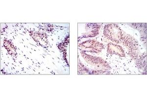 Immunohistochemistry (IHC) image for anti-Yes-Associated Protein 1 (YAP1) antibody (ABIN1109527) (YAP1 antibody)