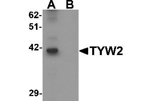 Western blot analysis of TYW2 in K562 cell lysate with TYW2 antibody at 0. (TRMT12 antibody  (N-Term))