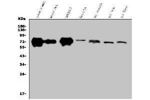 Western blot analysis of Golm1/GOLPH2 using anti-Golm1/GOLPH2 antibody (ABIN7601504).
