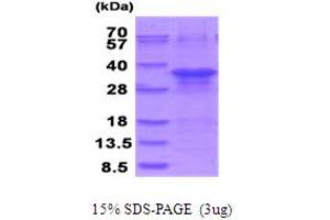 SDS-PAGE (SDS) image for Zinc Finger, AN1-Type Domain 5 (ZFAND5) (AA 1-213) protein (His tag) (ABIN5854034)