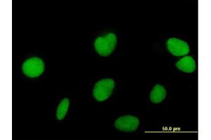 Immunofluorescence of purified MaxPab antibody to ZNF573 on HeLa cell. (ZNF573 antibody  (AA 1-645))