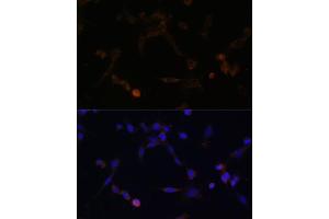 Immunofluorescence analysis of NIH/3T3 cells using UBE2L6 antibody (ABIN6134446, ABIN6149808, ABIN6149809 and ABIN6217753) at dilution of 1:100. (UBE2L6 antibody  (C-Term))