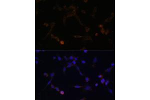 Immunofluorescence analysis of NIH/3T3 cells using UBE2L6 antibody (ABIN6134446, ABIN6149808, ABIN6149809 and ABIN6217753) at dilution of 1:100. (UBE2L6 antibody  (C-Term))