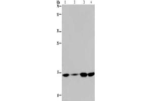 Gel: 10 % SDS-PAGE, Lysate: 40 μg, Lane 1-4: Hela cells, 231 cells, K562 cells, human fetal brain tissue, Primary antibody: ABIN7190953(HIST1H2AB Antibody) at dilution 1/200, Secondary antibody: Goat anti rabbit IgG at 1/8000 dilution, Exposure time: 5 minutes