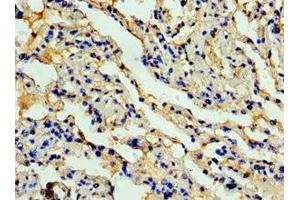 Immunohistochemistry of paraffin-embedded human lung tissue using  at dilution of 1:100 (CCL11 antibody  (AA 1-97))