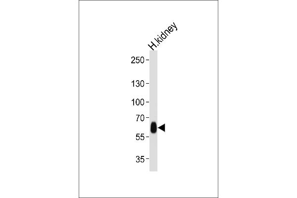 DFNB31 antibody  (AA 378-406)