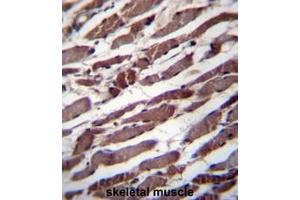 PUS1 Antibody (C-term) immunohistochemistry analysis in formalin fixed and paraffin embedded human skeletal muscle followed by peroxidase conjugation of the secondary antibody and DAB staining. (TBC1D22A antibody  (C-Term))