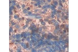 Figure. (EPB42 antibody  (AA 475-686))