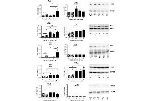 mRNA expression (all n = 6) of HRas, MAPK14 (p38), CCL2, DOK1 and PTK2B related to GAPDH mRNA expression, protein expression of HRas (n = 6), p38 (n = 6), CCL2 (n = 4), DOK1 (n = 7-8) and PTK2B (n = 3) related to GAPDH expression in A549 () and A549rCDDP2000 () before (ctrl) and after treatment with 11 μM cisplatin (11) or 34 μM cisplatin (34) presented as mean ± SEM, as well as representative Western blots.