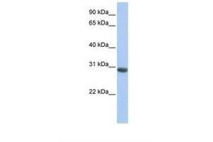 Image no. 1 for anti-Myeloid Leukemia Factor 1 (MLF1) (AA 38-87) antibody (ABIN6738901) (MLF1 antibody  (AA 38-87))
