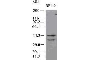 DFF45 antibody (3F12) at 1:500 dilution + Hela cell lysate (DFFA antibody)