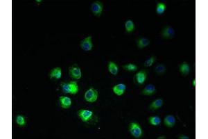 Immunofluorescent analysis of A2780 cells using ABIN7165108 at dilution of 1:100 and Alexa Fluor 488-congugated AffiniPure Goat Anti-Rabbit IgG(H+L) (ARV1 antibody  (AA 1-143))