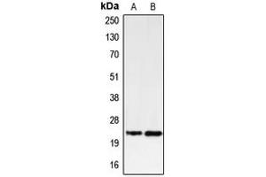 Western blot analysis of PUMA expression in K562 (A), U937 (B) whole cell lysates. (PUMA antibody  (C-Term))
