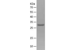 Western Blotting (WB) image for Tensin 3 (TNS3) (AA 366-571) protein (His tag) (ABIN7283367) (TNS3 Protein (AA 366-571) (His tag))