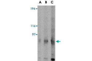 Western blot analysis of GRIK4 in rat brain tissue lysate with GRIK4 polyclonal antibody  at (A) 0. (GRIK4 antibody  (C-Term))