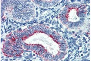 Human Uterus: Formalin-Fixed, Paraffin-Embedded (FFPE) (TYMS antibody  (AA 111-211))