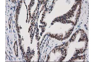 Image no. 1 for anti-Protein Kinase C, epsilon (PRKCE) antibody (ABIN1500230)